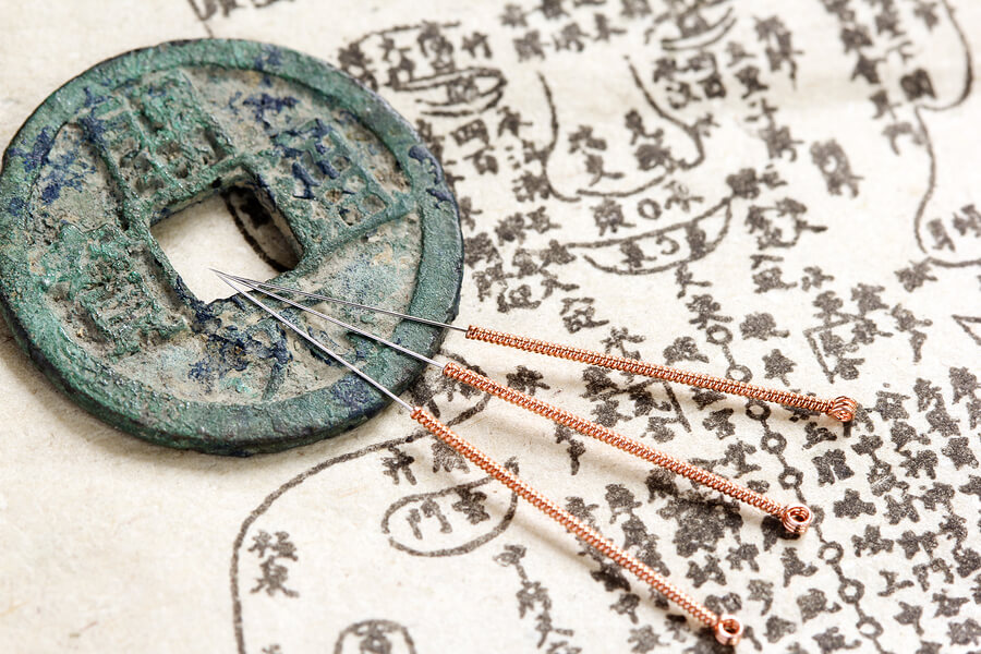 Photo site Qi-reliance.fr - photo principale acupuncture